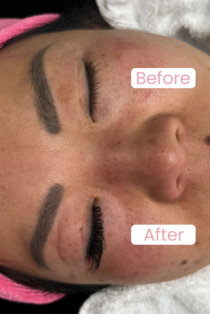 Lashes extensions / Extensão de cílios