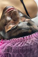 Black peel / Peeling de Hollywood